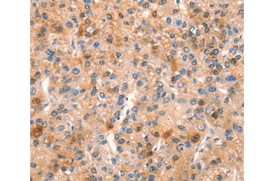 Immunohistochemistry - SPRN Antibody from Signalway Antibody (37026) - Antibodies.com