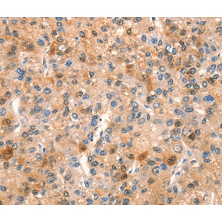 Immunohistochemistry - SPRN Antibody from Signalway Antibody (37026) - Antibodies.com