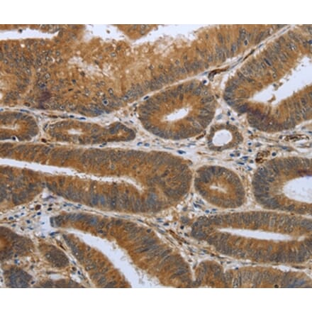 Immunohistochemistry - SHBG Antibody from Signalway Antibody (37027) - Antibodies.com