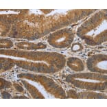 Immunohistochemistry - SHBG Antibody from Signalway Antibody (37027) - Antibodies.com