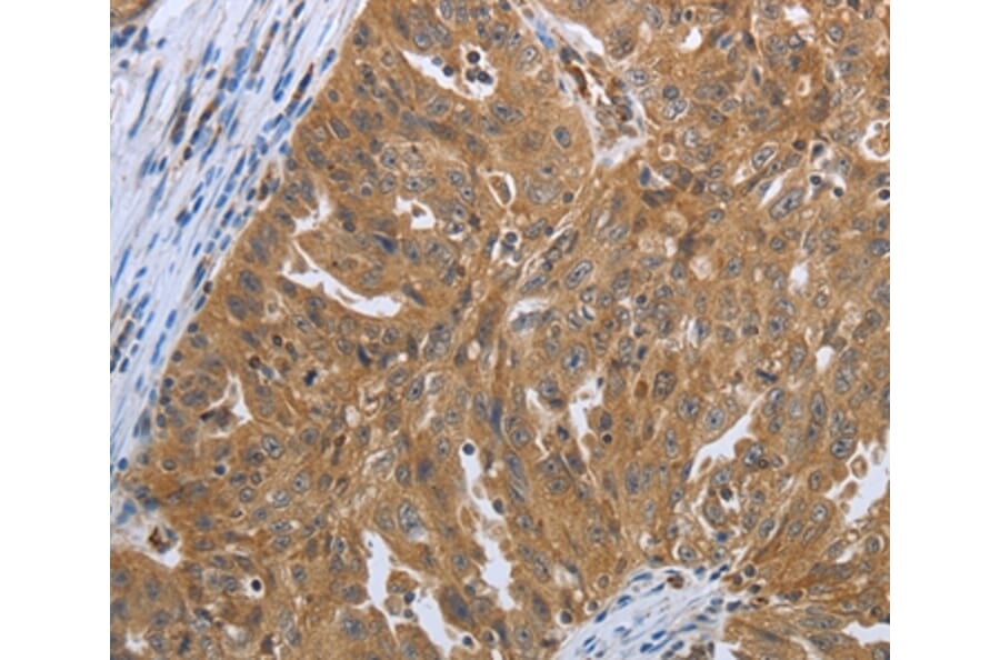 Immunohistochemistry - SHBG Antibody from Signalway Antibody (37027) - Antibodies.com