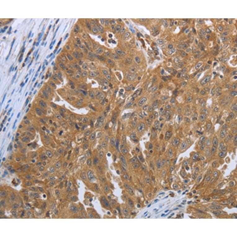 Immunohistochemistry - SHBG Antibody from Signalway Antibody (37027) - Antibodies.com