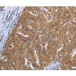 Immunohistochemistry - SHBG Antibody from Signalway Antibody (37027) - Antibodies.com