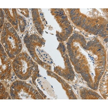Immunohistochemistry - SUN5 Antibody from Signalway Antibody (37040) - Antibodies.com