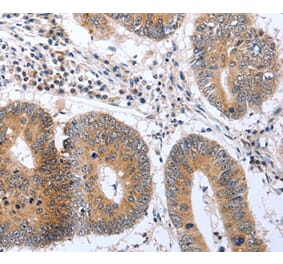 Immunohistochemistry - PSPN Antibody from Signalway Antibody (37041) - Antibodies.com
