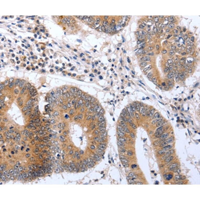 Immunohistochemistry - PSPN Antibody from Signalway Antibody (37041) - Antibodies.com