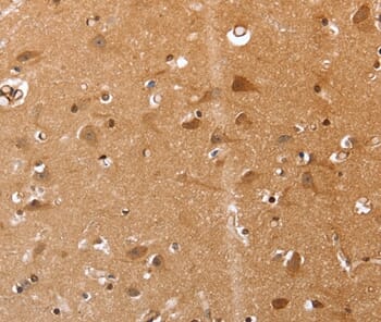 Immunohistochemical analysis of paraffin-embedded Human brain tissue using #37045 at dilution 1/20.