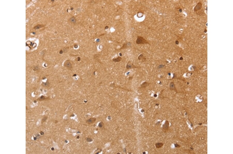 Immunohistochemistry - VIMP Antibody from Signalway Antibody (37045) - Antibodies.com
