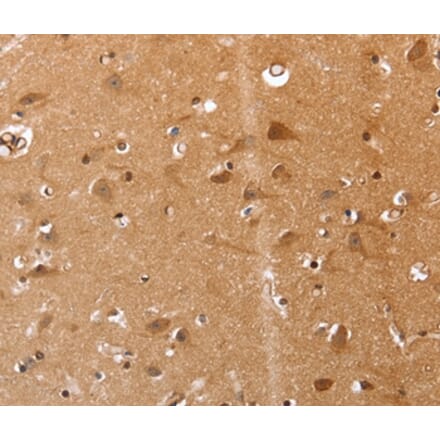 Immunohistochemistry - VIMP Antibody from Signalway Antibody (37045) - Antibodies.com