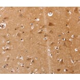 Immunohistochemistry - VIMP Antibody from Signalway Antibody (37045) - Antibodies.com