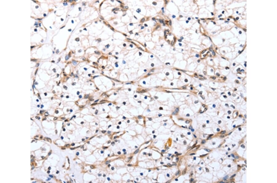 Immunohistochemistry - VIMP Antibody from Signalway Antibody (37045) - Antibodies.com