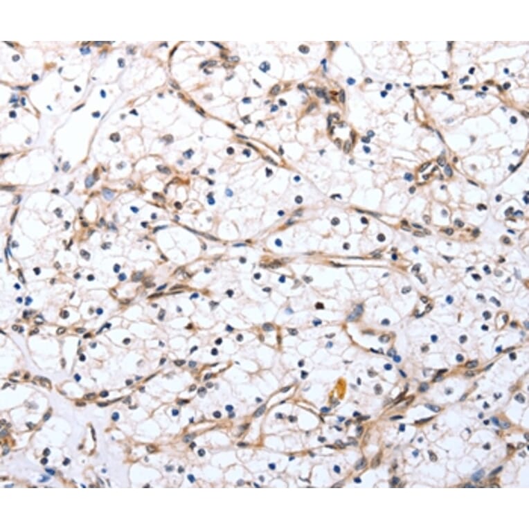 Immunohistochemistry - VIMP Antibody from Signalway Antibody (37045) - Antibodies.com