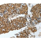 Immunohistochemistry - YBX1 Antibody from Signalway Antibody (37062) - Antibodies.com