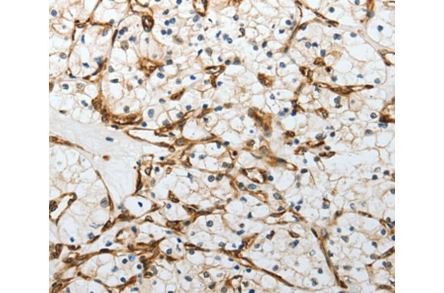 Immunohistochemistry - YBX1 Antibody from Signalway Antibody (37062) - Antibodies.com
