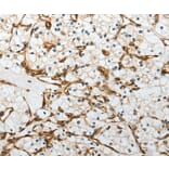 Immunohistochemistry - YBX1 Antibody from Signalway Antibody (37062) - Antibodies.com
