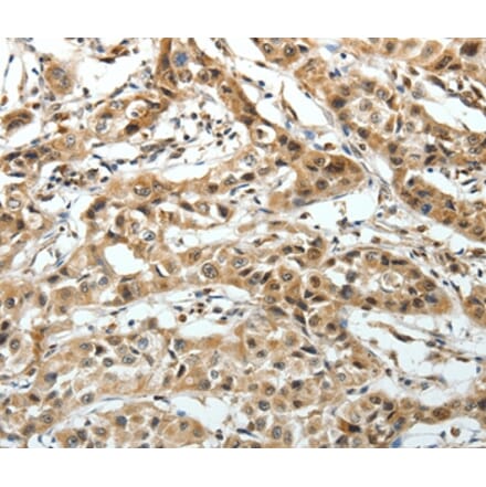 Immunohistochemistry - FZD3 Antibody from Signalway Antibody (37069) - Antibodies.com