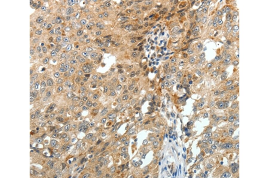 Immunohistochemistry - FZD3 Antibody from Signalway Antibody (37069) - Antibodies.com