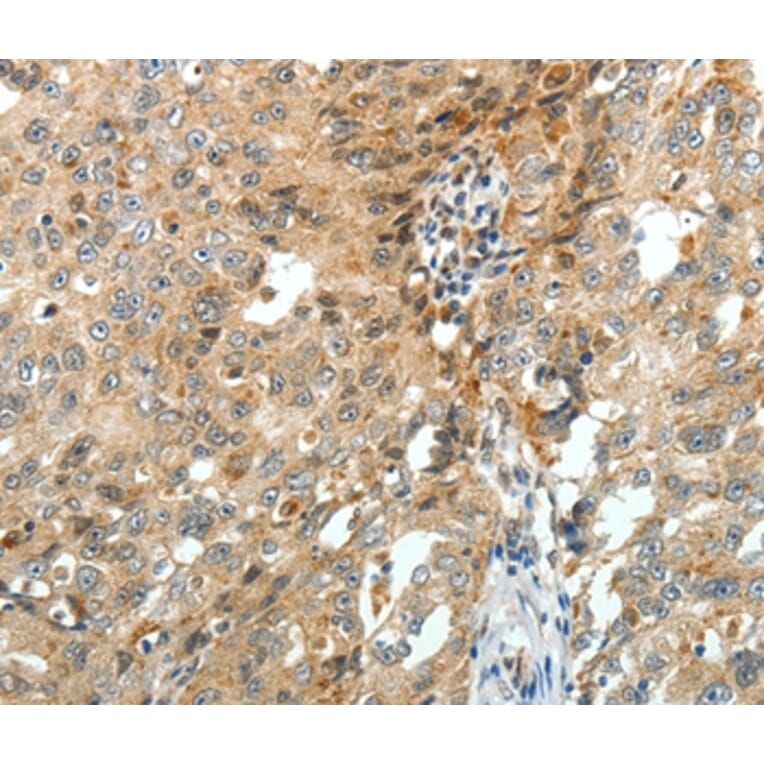 Immunohistochemistry - FZD3 Antibody from Signalway Antibody (37069) - Antibodies.com