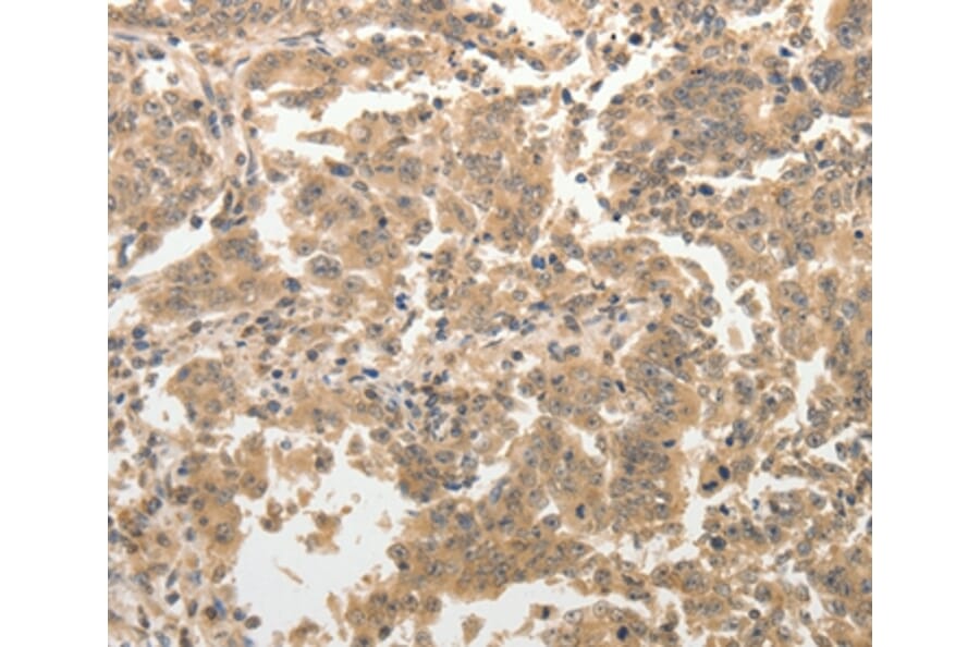 Immunohistochemistry - ADAR Antibody from Signalway Antibody (37084) - Antibodies.com