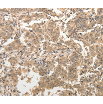Immunohistochemistry - ADAR Antibody from Signalway Antibody (37084) - Antibodies.com