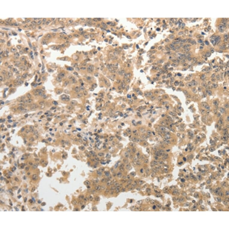 Immunohistochemistry - ADAR Antibody from Signalway Antibody (37084) - Antibodies.com