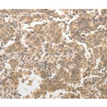 Immunohistochemistry - ADAR Antibody from Signalway Antibody (37084) - Antibodies.com