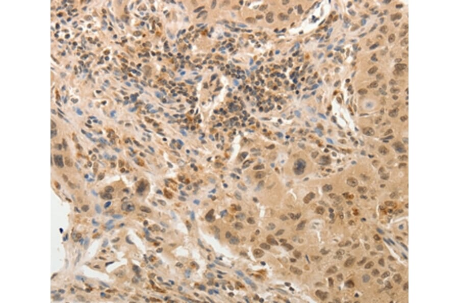 Immunohistochemistry - ADAR Antibody from Signalway Antibody (37084) - Antibodies.com