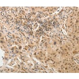 Immunohistochemistry - ADAR Antibody from Signalway Antibody (37084) - Antibodies.com