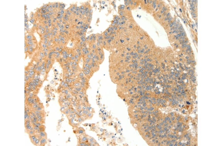 Immunohistochemistry - AGRP Antibody from Signalway Antibody (37093) - Antibodies.com
