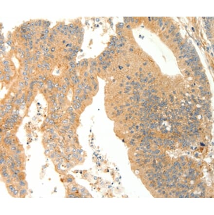 Immunohistochemistry - AGRP Antibody from Signalway Antibody (37093) - Antibodies.com