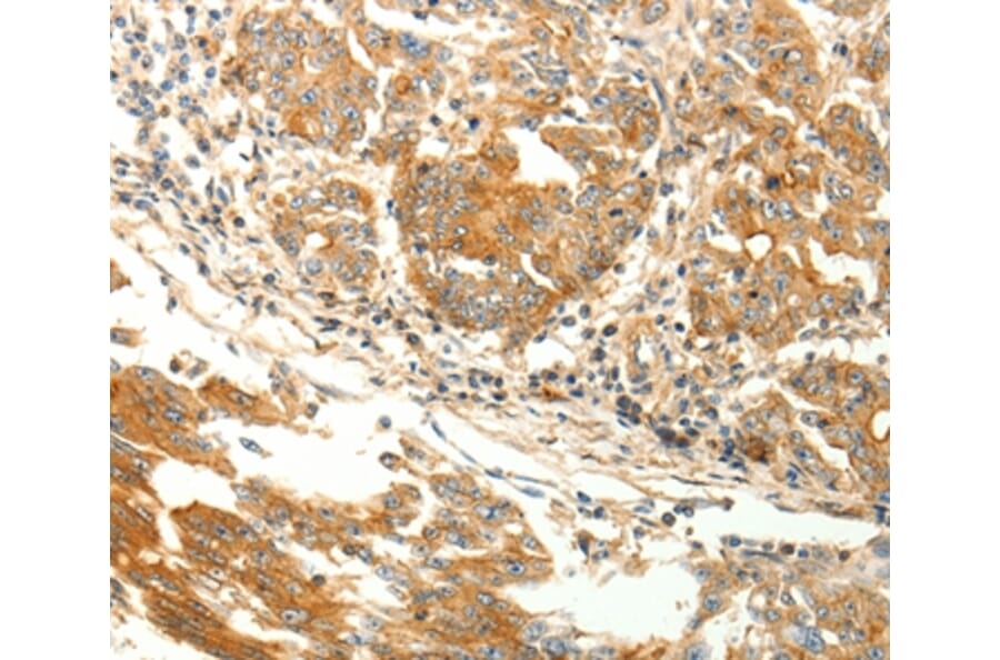 Immunohistochemistry - AGRP Antibody from Signalway Antibody (37093) - Antibodies.com