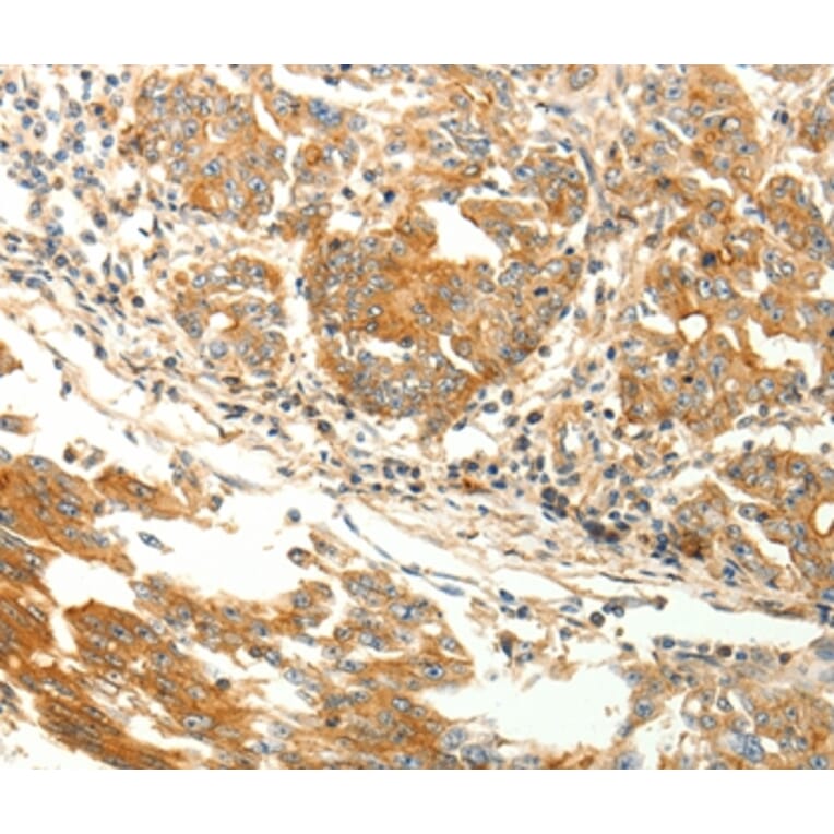 Immunohistochemistry - AGRP Antibody from Signalway Antibody (37093) - Antibodies.com