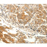 Immunohistochemistry - AGRP Antibody from Signalway Antibody (37093) - Antibodies.com