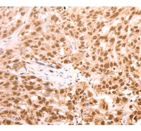 Immunohistochemistry - AMD1 Antibody from Signalway Antibody (37098) - Antibodies.com
