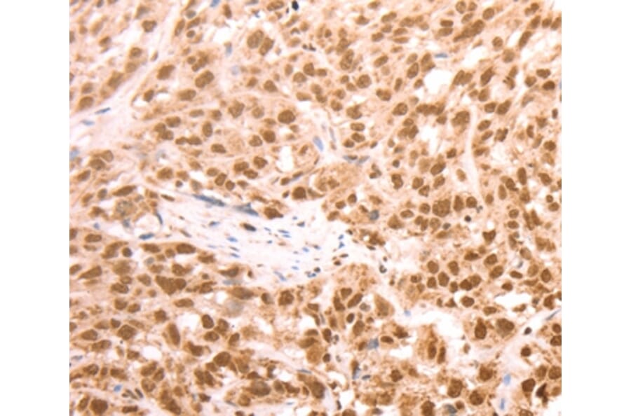 Immunohistochemistry - AMD1 Antibody from Signalway Antibody (37098) - Antibodies.com