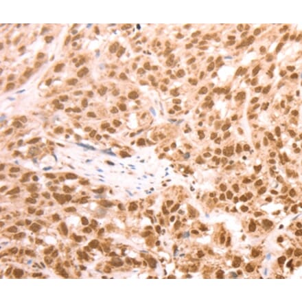 Immunohistochemistry - AMD1 Antibody from Signalway Antibody (37098) - Antibodies.com