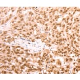 Immunohistochemistry - AMD1 Antibody from Signalway Antibody (37098) - Antibodies.com