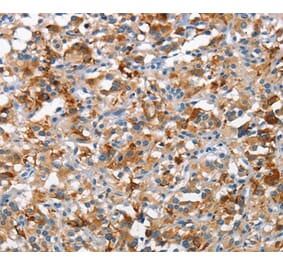 Immunohistochemistry - TSC2 Antibody from Signalway Antibody (37108) - Antibodies.com