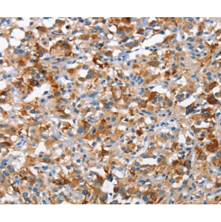 Immunohistochemistry - TSC2 Antibody from Signalway Antibody (37108) - Antibodies.com