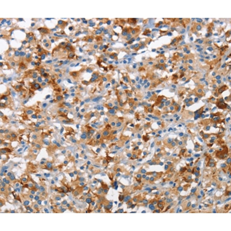 Immunohistochemistry - TSC2 Antibody from Signalway Antibody (37108) - Antibodies.com