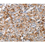 Immunohistochemistry - TSC2 Antibody from Signalway Antibody (37108) - Antibodies.com