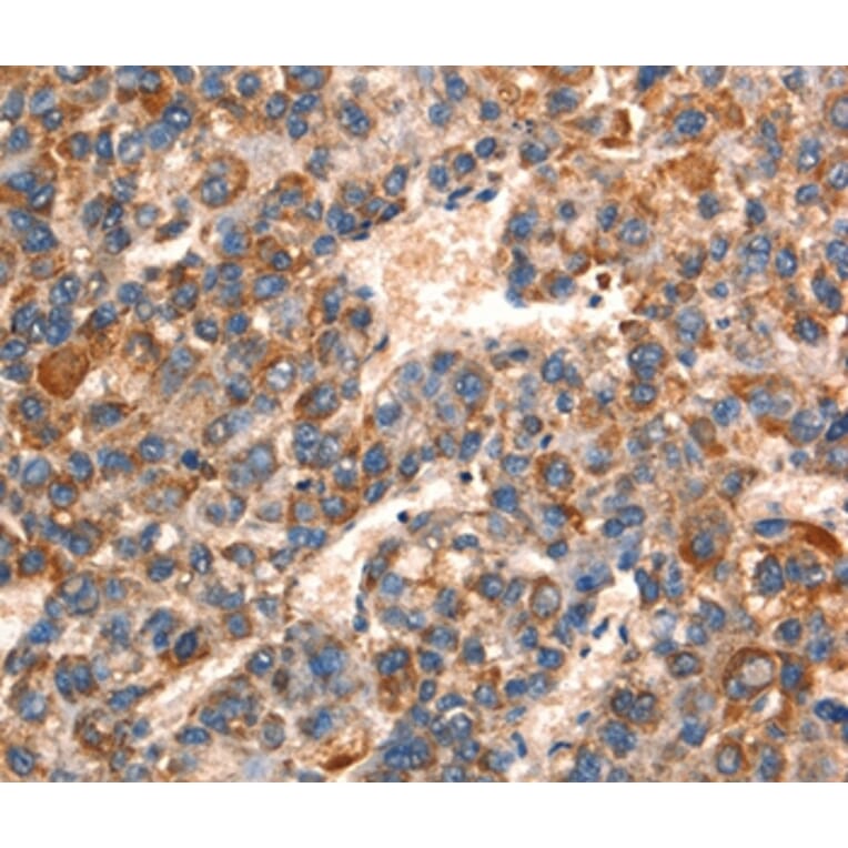 Immunohistochemistry - GJA8 Antibody from Signalway Antibody (37121) - Antibodies.com