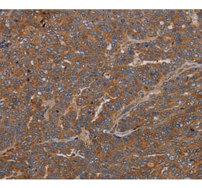 Immunohistochemistry - GDF2 Antibody from Signalway Antibody (37122) - Antibodies.com