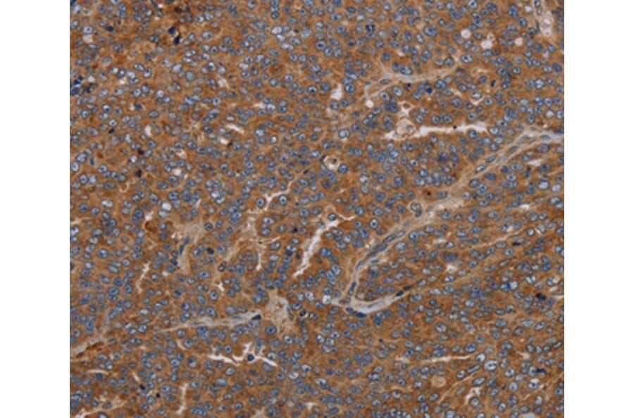 Immunohistochemistry - GDF2 Antibody from Signalway Antibody (37122) - Antibodies.com