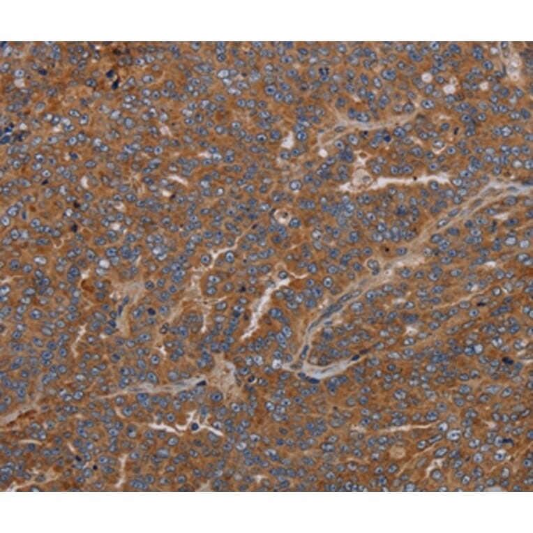 Immunohistochemistry - GDF2 Antibody from Signalway Antibody (37122) - Antibodies.com