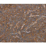 Immunohistochemistry - GDF2 Antibody from Signalway Antibody (37122) - Antibodies.com