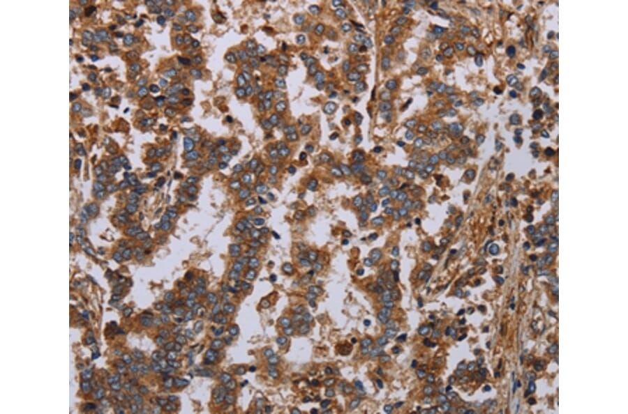 Immunohistochemistry - GDF2 Antibody from Signalway Antibody (37122) - Antibodies.com