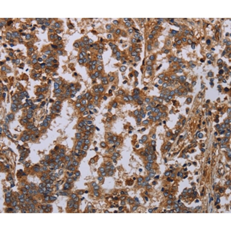 Immunohistochemistry - GDF2 Antibody from Signalway Antibody (37122) - Antibodies.com