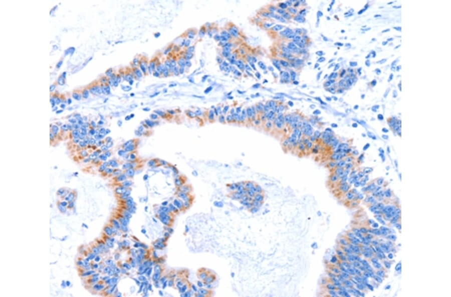 Immunohistochemistry - SMG8 Antibody from Signalway Antibody (37142) - Antibodies.com