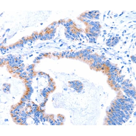 Immunohistochemistry - SMG8 Antibody from Signalway Antibody (37142) - Antibodies.com